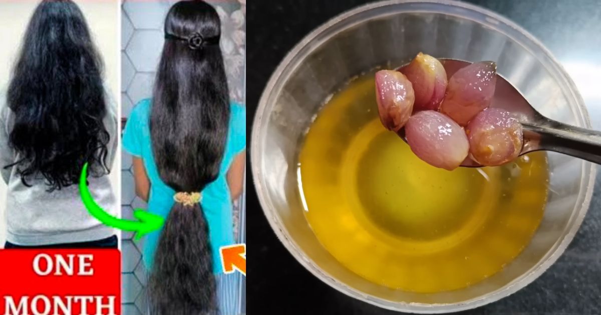 Small Onion Hair Oil for Hair growth