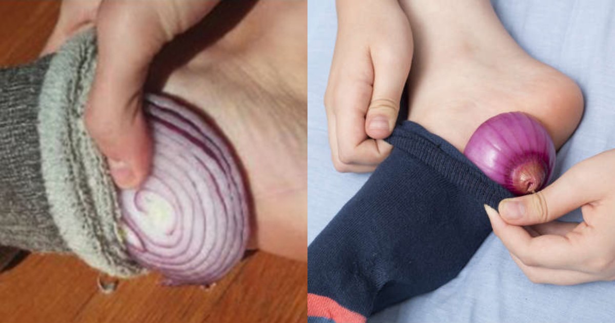 Onion On Feet Benefits
