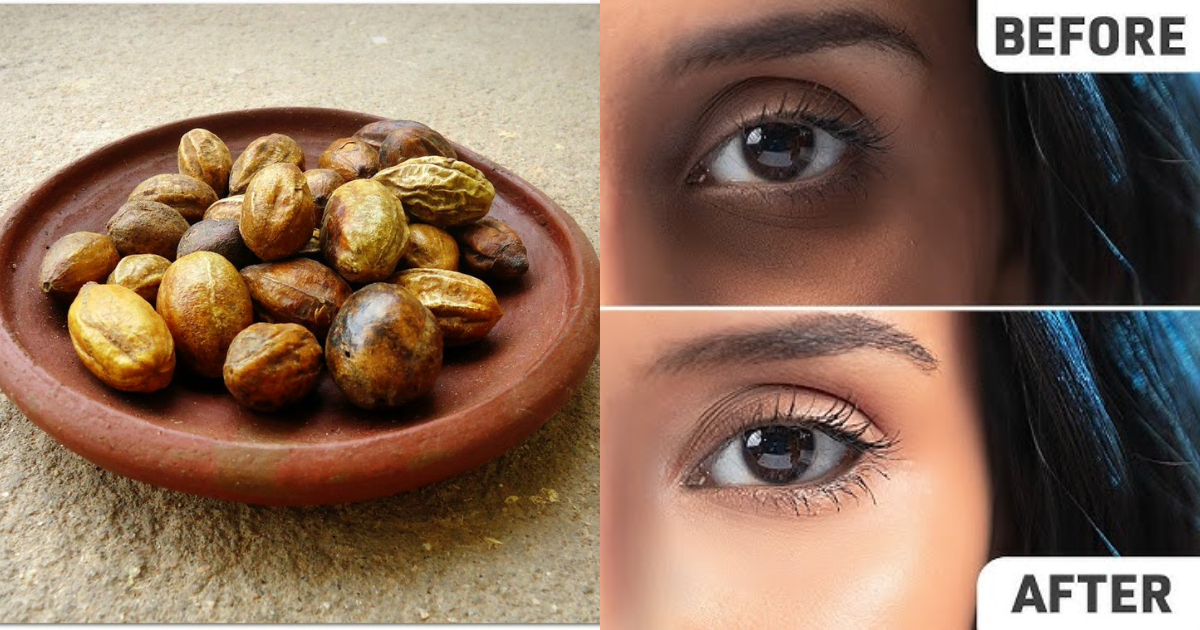 Remedy for dark circles under eyes