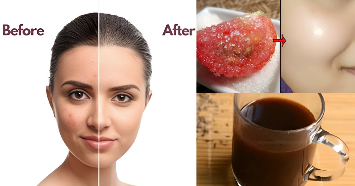 Sun tan removeal at home