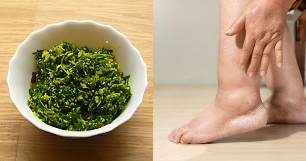 Calcium deficiency remedy