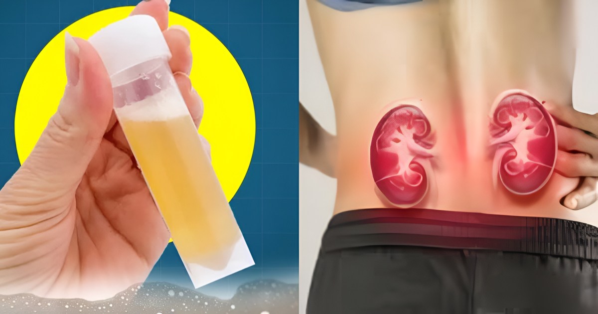 Kidney health care tips