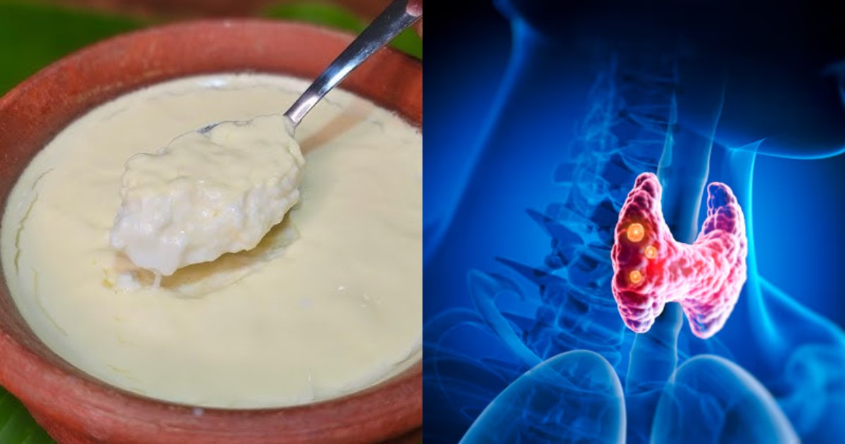 Thyroid Disease home remedy