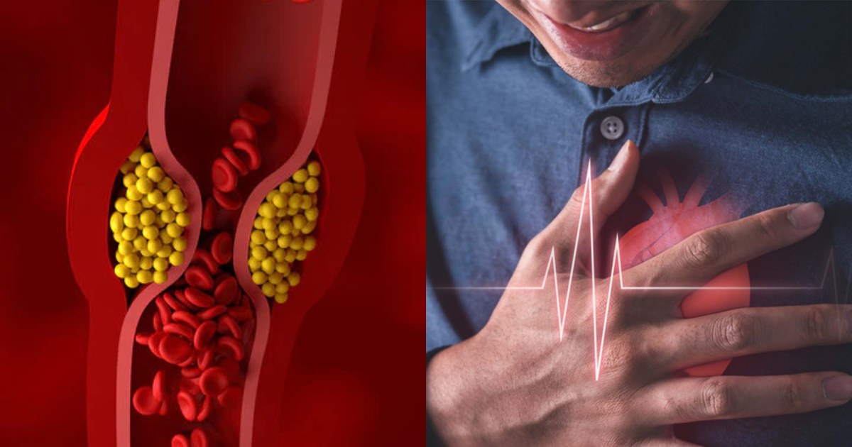 Triglyceride control diet