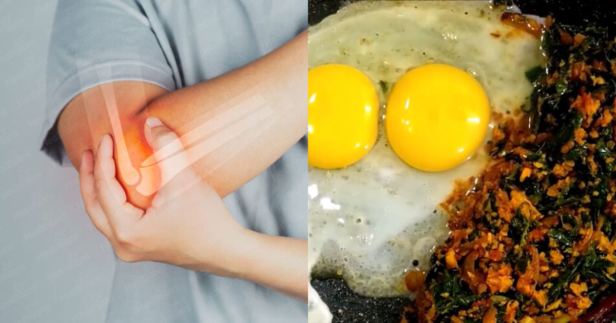 Calcium defficiency home remedy